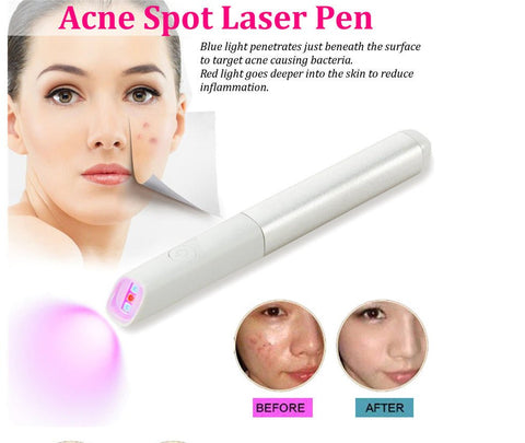 Acne Pen Repair Instrument-Red & Blue Light Facial Beauty Device Soloist