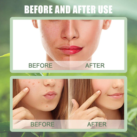 Green Tea Mask Stick - Spreadable Mud Mask for Acne & Pore Tightening Soloist