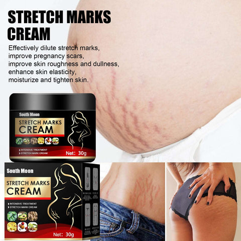 Stretch Mark Repair Cream-Fades Postpartum and Obesity-related Stretch Marks Soloist