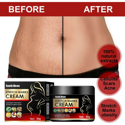 Stretch Mark Repair Cream-Fades Postpartum and Obesity-related Stretch Marks Soloist