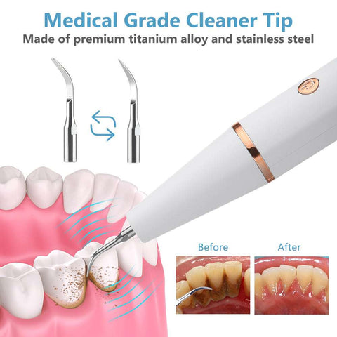 True Ultrasonic Dental Cleaner - Smart Stain & Tartar Remover Soloist