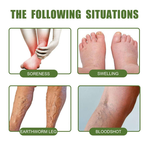 Vein Repair Cream - Varicose Legs Relief & Massage Care Soloist
